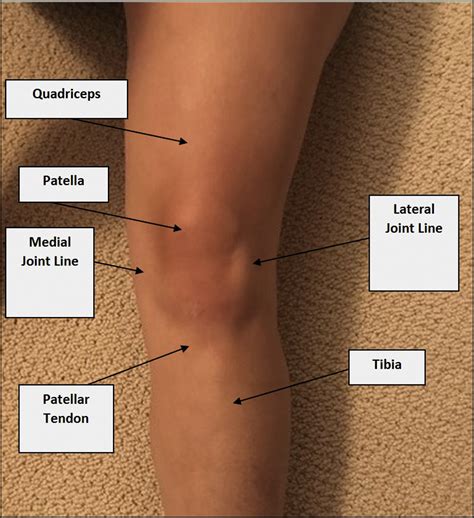 Knee Pain Area Chart