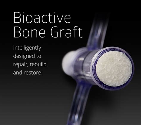 Bioactive Bone Graft Unite Foot And Ankle