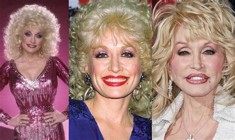 If you buy from a link, we may earn a commission. Dolly Parton Plastic Surgery Before and After Pictures 2021