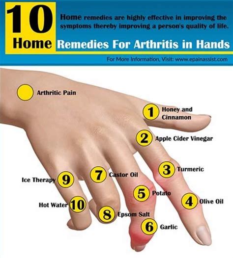 Remedies For Arthritis In Hands Natural Cure For Arthritis Home