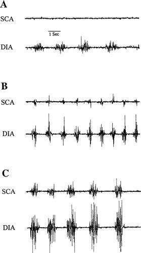 Functional Role And Structure Of The Scalene An Accessory Inspiratory