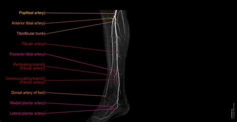 Arteries And Bones Of The Lower Limb Interactive Atlas Of Human
