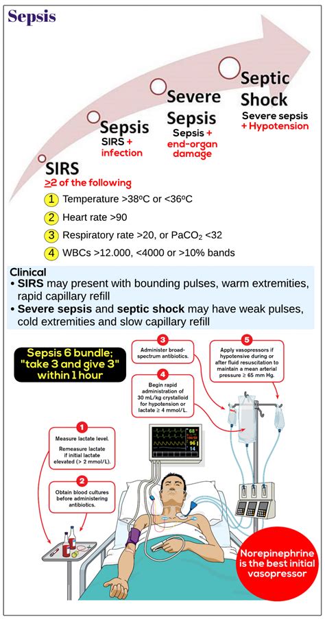 Sepsis And Septic Shock Medicine Keys For MRCPs