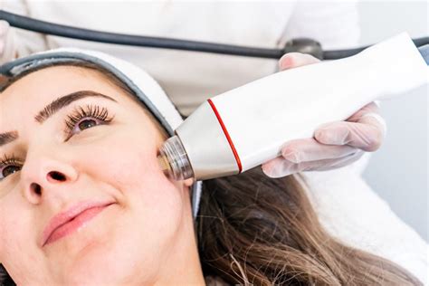 Microneedling Fractional Rf Dermatique Med Spa Laser Hair Removal Microneedling Facial