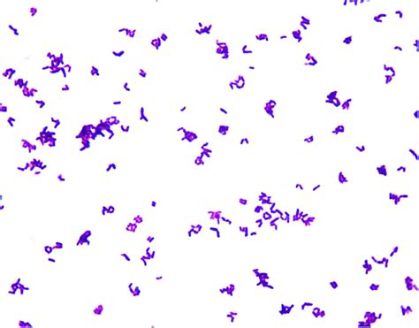 Gram Stain Of C Striatum Shows Typical Coryneform Morphology