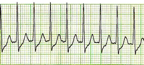 Filesvt Lead Ii 2