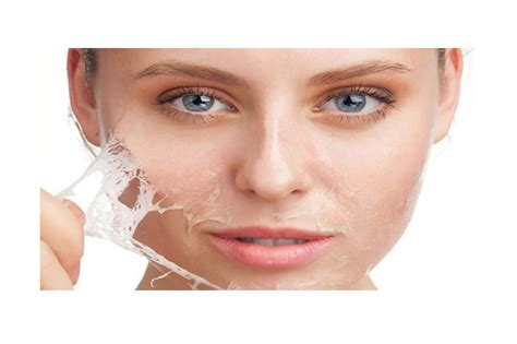 Chemical Peeling - EPA - SkinClinic