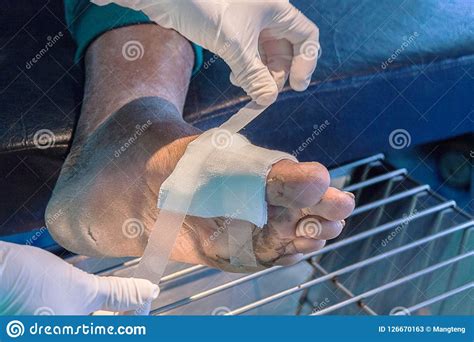 Foot Infected Wound Stock Image Image Of Medical Ulcers 126670163