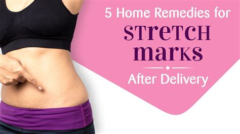 5 Effective Home Remedies For Pregnancy Stretch Marks Youtube