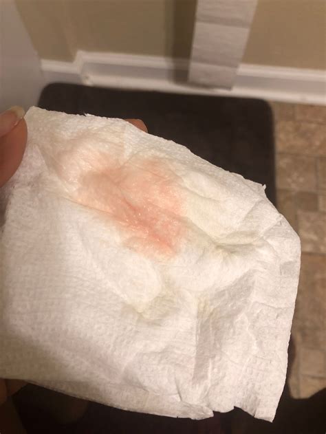 Light Pink Spotting When I Wipe 2 Weeks After Period