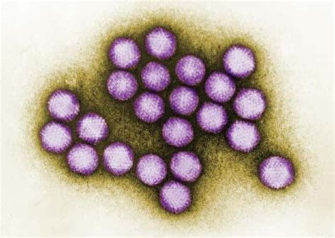 Adenovirus Infection Transmission Symptoms Britannica