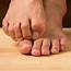 Hallux Rigidus Aka Turf Toe  The Foot And Ankle Clinic