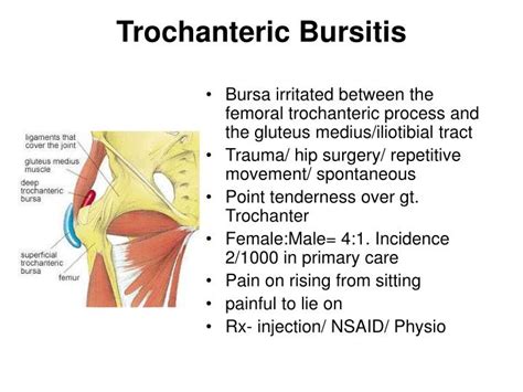 Ppt Trochanteric Bursitis Powerpoint Presentation Id1209260