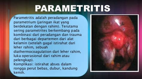 Penyakit Radang Panggul Pelvic Inflammatory Disease