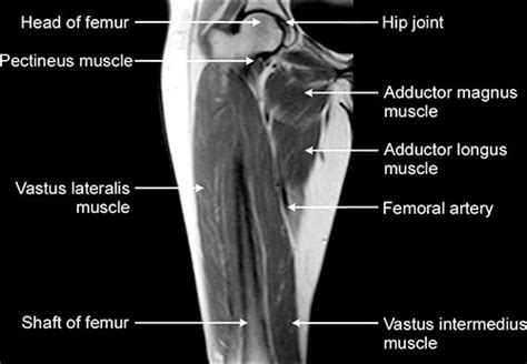Upper Thigh Mri Anatomy Figure 4 From Normal Mr Imaging Anatomy Of