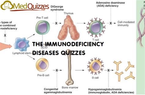 Immunology The Immunodeficiency Diseases Quizzes 8 Tests Medquizzes