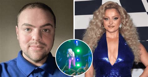 who is nicolas malvagna bebe rexha gets 3 stitches on face after man