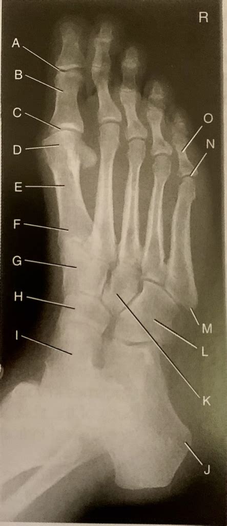 Labeled Foot X Ray Ap Medial Oblique Diagram Quizlet
