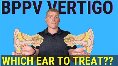 How To Tell Which Ear To Treat For Bppv Using Half Somersault Maneuver