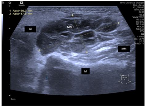 Jcm Free Full Text Ultrasound In Inflammatory And Obstructive