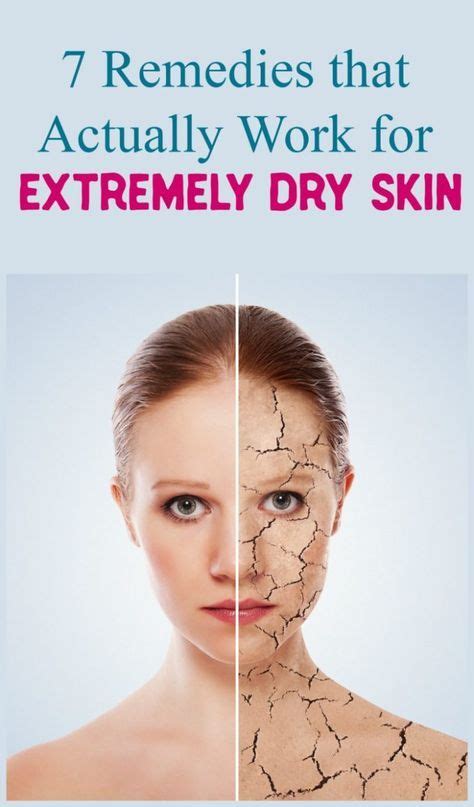 Dealing With Extremely Dry Skin Check Out Tried And True Remedies Of Out