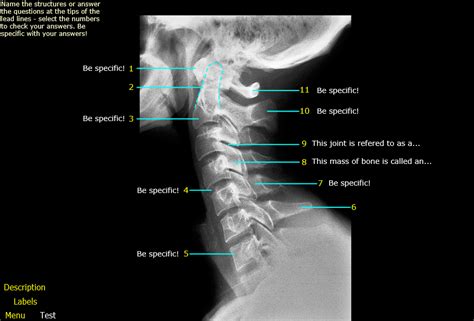 Head And Neck Cervical Spine Lateral View 10 Diagram Quizlet