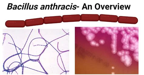 Bacillus Anthracis An Overview