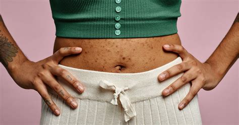 Why Do Belly Buttons Smell Causes And Treatments