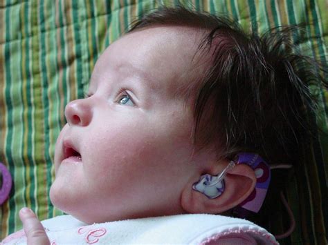 Supporting Success For Children With Hearing Loss Ear Gear Parents