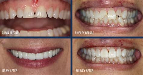 6 Common Dental Problems You Can Fix With Cosmetic Dentistry Bradley