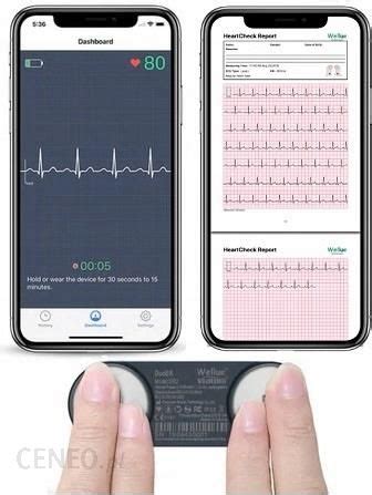 Drobne Akcesoria Medyczne Monitor Ekg Er Arytmia Migotanie Przedsionk W Ceny I Opinie Ceneo Pl