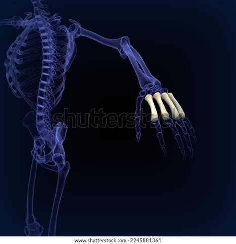 Human Metacarpal Bones Anatomy Medical Illustration3d Stock
