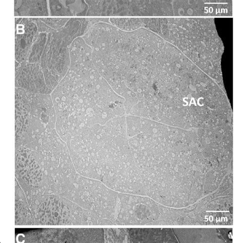 Transmission Electron Microscopic Tem Images Of Anther Locules In