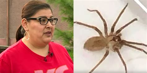 Doctors Find Venomous Brown Recluse Spider In Womans Ear