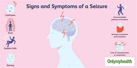 Epilepsy Care Know What To Do During Recurrent Seizures With These