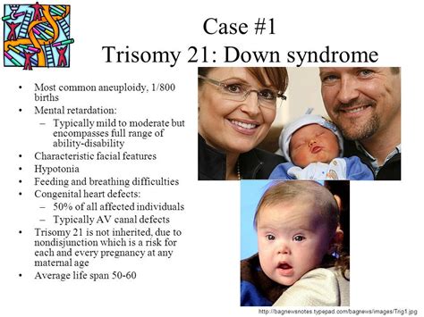 One cell has two 21st chromosomes instead of one, so the resulting fertilized egg has three 21st chromosomes. Pin by nonas arc on Trisomy 21 (aka Downs Syndrome ...