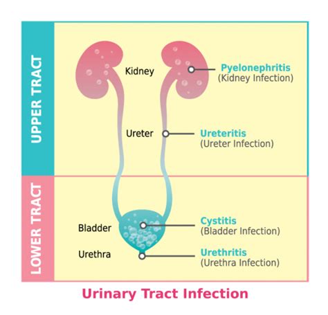 understanding uti utipure the trusted urinary alkalinizer for women s urinary tract
