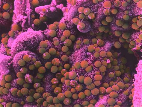 Cryptosporidium parvum is a protozoan parasite that can infect a range of mammals including • only 5 oocysts are needed to cause infection, so a single calf has a huge potential to infect other. Cryptosporidium Parvum Parasites Photograph by Moredun Scientific Ltd/science Photo Library
