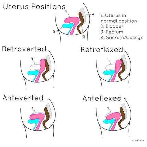 Period Cramp Positions