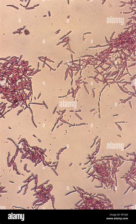 Escherichia Coli Petri Hi Res Stock Photography And Images Alamy