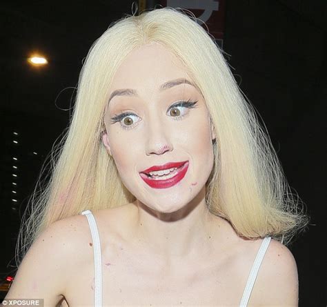 Iggy Azalea Leaves Dynamo Gig With Unsightly Lipstick Smudged Across Her Nose And Chin Daily