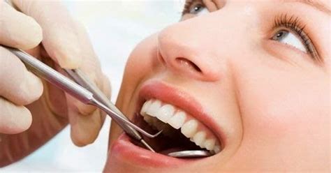 Harga Implan Gigi Tanam Gigi Klinik Swasta
