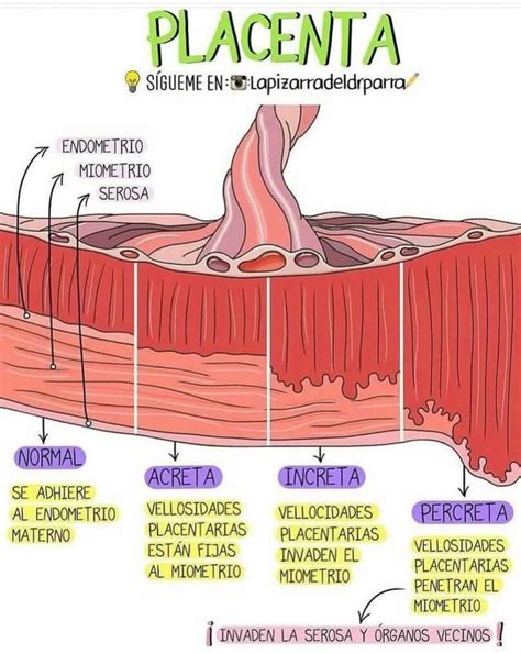 Tipos De Placenta Anatomía Médica Obstetricia Y Puericultura