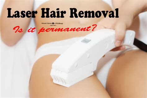 Permanent Laser Hair Removal Procedure Side Effects