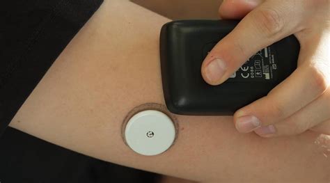 Abbotts Freestyle Libre A New Painless Way To Handle Time In Variety For Diabetes Patients