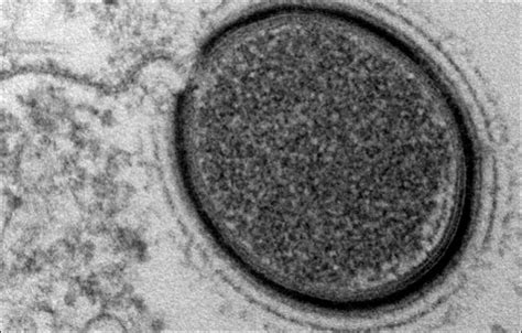 Warning On Deadly Ancient Viruses Awakening In Siberia As Climate