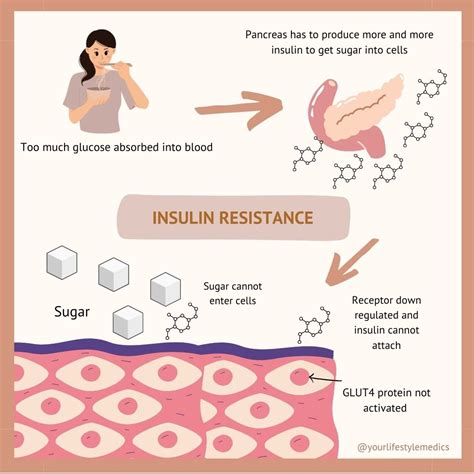 All You Need To Know About Insulin Resistance Your Lifestyle Medics