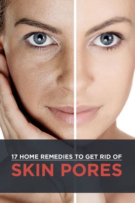 17 Effective Home Remedies For Skin Pores Home Remedies For Skin