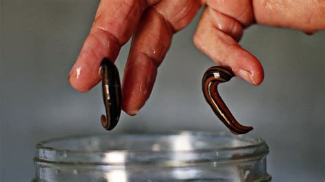 How A Bloodsucking Craze Caused A Global Shortage Of Leeches Herald Sun