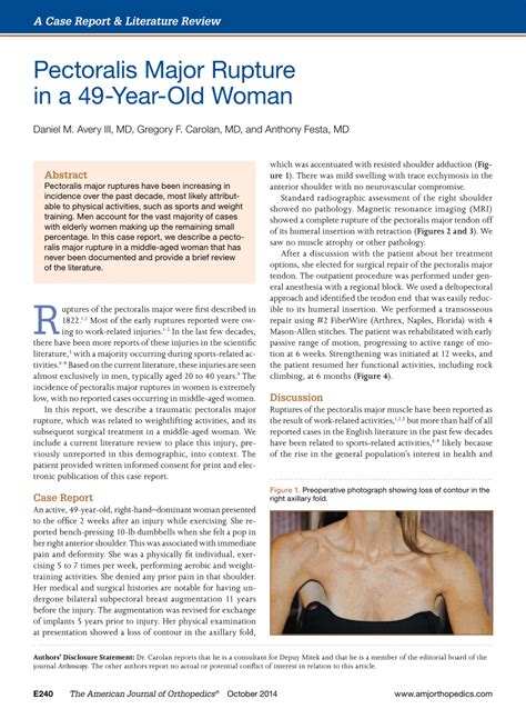 Even a single case study report of injury to the female athletic population. (PDF) Pectoralis major rupture in a 49-year-old woman